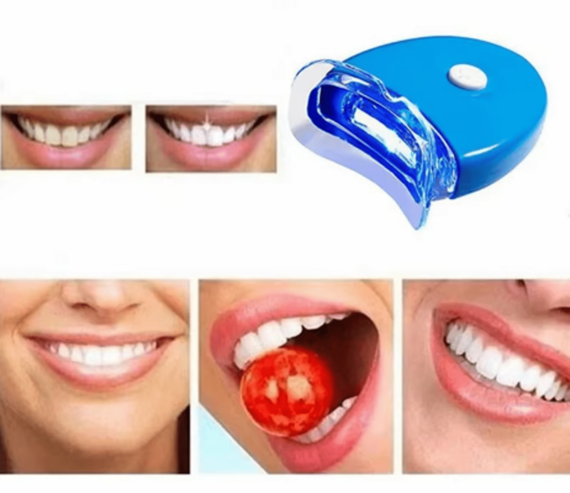 Kit de blanqueamiento dental inalámbrico para uso doméstico - 2